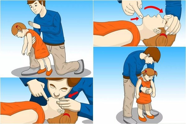 Nguyên nhân, cách phòng tránh hóc dị vật ở trẻ